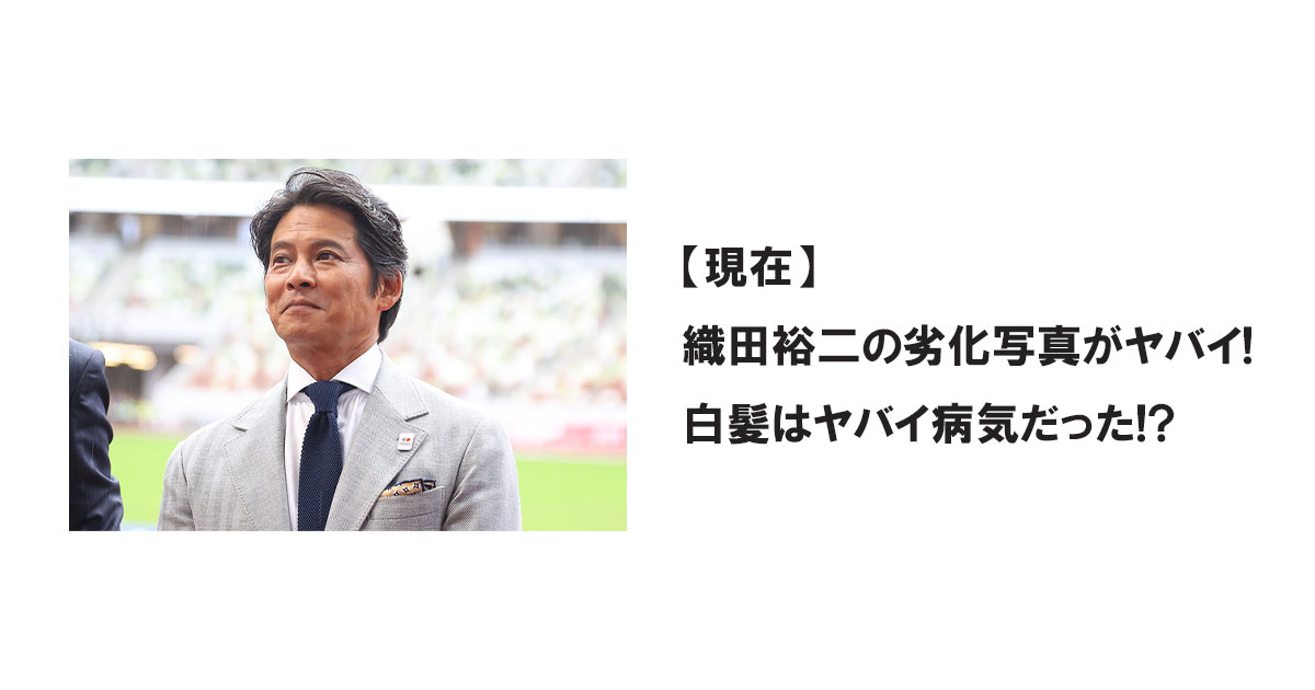 【現在】織田裕二の劣化写真がヤバイ!白髪はヤバイ病気だった!?